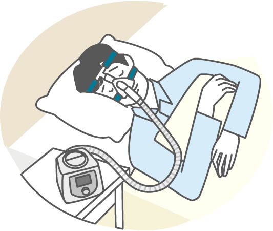 睡眠時無呼吸症候群の治療